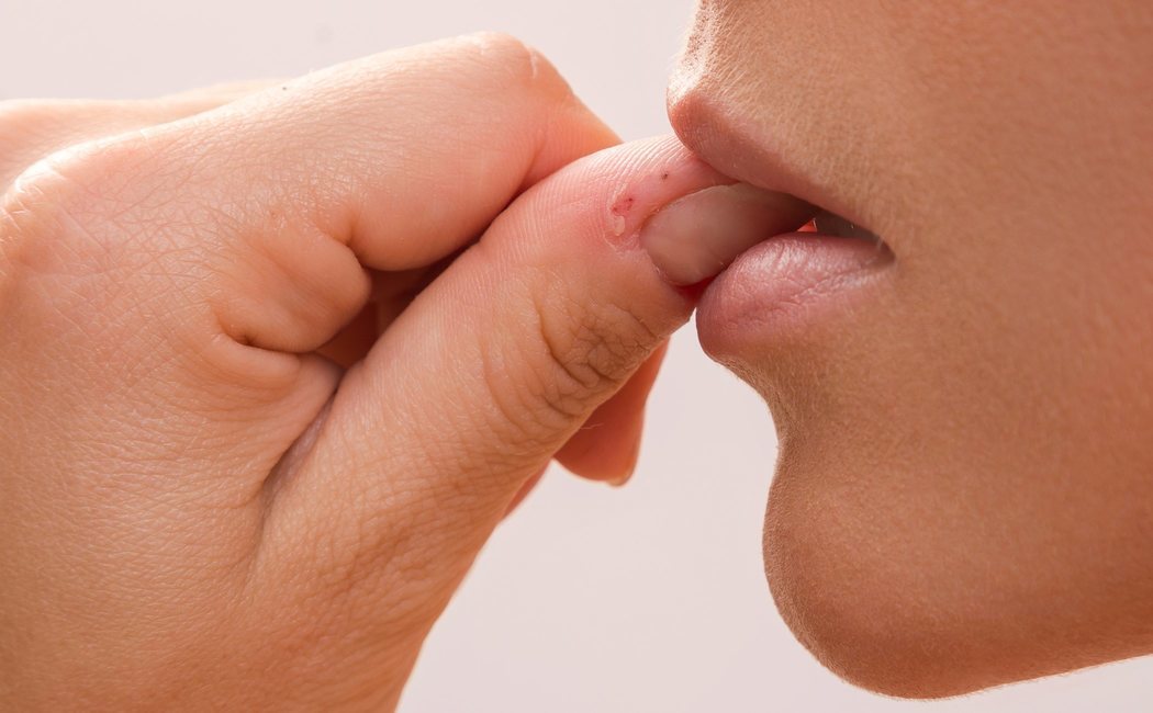 Onicofagia: cómo dejar de morderse las uñas