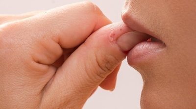 Onicofagia: cómo dejar de morderse las uñas
